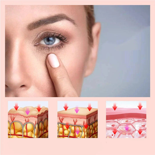 Eye bags beauty equipment Trendy Home Improvements